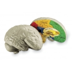 Secţiune creier