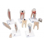 Set modele dinţi - clasic - 5 modele (3BS)
